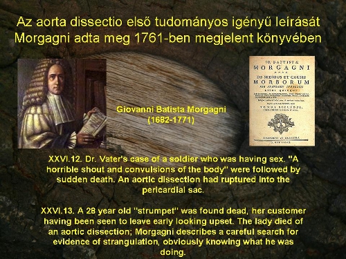 Giovanni Batista Morgagni, s az általa írt De Sedibus et causis morborum per anatomem indagatis című könyv, melyben elsőként ad tudományos igényű leírást az aorta disszekcióról.